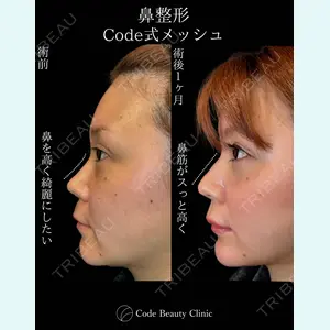 Code Beauty Clinic 名古屋院 橋本 祥平医師の症例