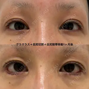エターナル美容クリニックの症例