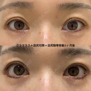 エターナル美容クリニック 久門田 詳医師の症例