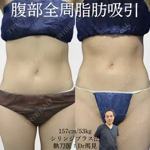 アムルーズ美容外科クリニック 大阪院 馬見 知大医師の症例