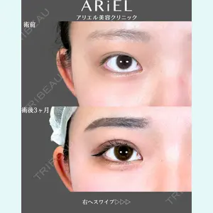 アリエル美容クリニック 郡山院 安齋 誠基医師の症例