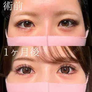 症例