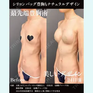 症例