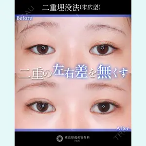 症例