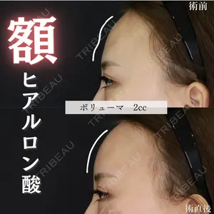 症例