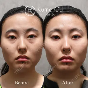 Kuma CLI 【クマクリ】 毛利 理人医師の症例