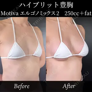 症例