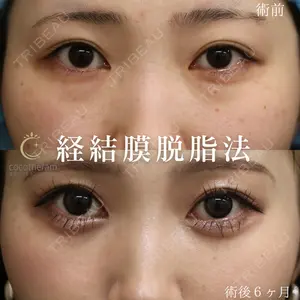 症例