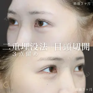 症例