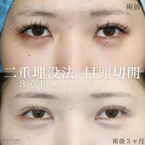 症例