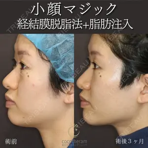 症例