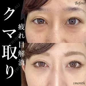 症例