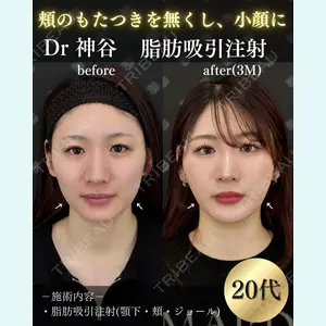 EMMO FACE CLINIC 大阪梅田院 神谷 一成医師の症例
