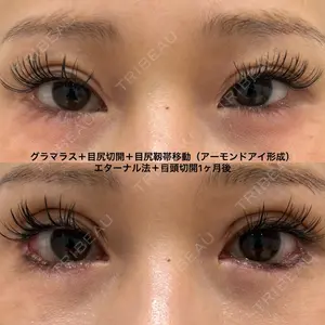 エターナル美容クリニック 久門田 詳医師の症例
