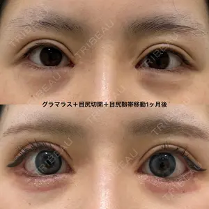 エターナル美容クリニックの症例