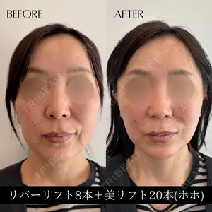 RIVER CLINIC（リバークリニック） 戸田 貴之医師の症例