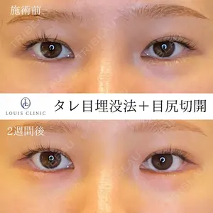 LOUIS CLINIC 二子玉川院【ルイクリニック】 小松 塁医師の症例