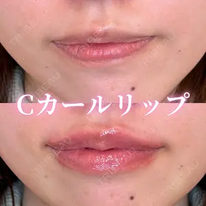 ルラ美容クリニック 大宮院 右京 大季医師の症例