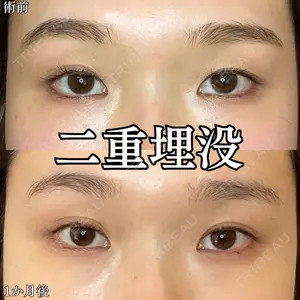 形成外科と美容外科のクリニック池袋 春日 航医師の症例