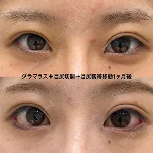 エターナル美容クリニック 久門田 詳医師の症例