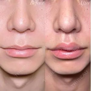 R Beauty CLINIC 銀座院 村山史朗医師の症例