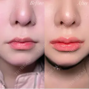 R Beauty CLINIC 銀座院 村山史朗医師の症例