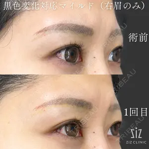 ziz CLINIC 村岡 史子医師の症例