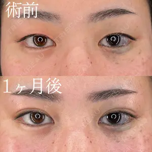HAAB×DREAM BEAUTY CLINIC 大阪梅田院 柏木 太雅医師の症例
