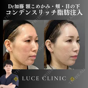 ルーチェクリニック 銀座院 加藤晴之輔医師の症例