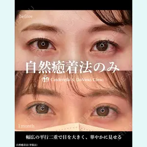 シンデレラ＆ダヴィンチクリニック 宮田 洋佑医師の症例