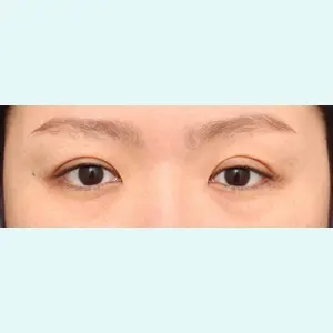 プリモ麻布十番クリニック 大場教弘医師の症例