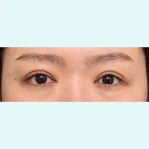 プリモ麻布十番クリニック 大場教弘医師の症例