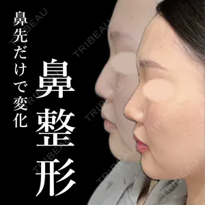 症例