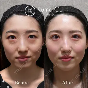 Kuma CLI 【クマクリ】 毛利 理人医師の症例