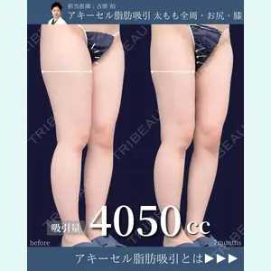 東京シンデレラ美容外科 新宿院 吉原 伯医師の症例