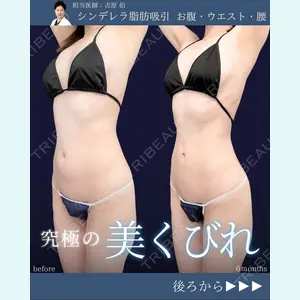 東京シンデレラ美容外科 新宿院 吉原 伯医師の症例