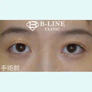 B-LINE CLINIC 池袋院 小池 康弘医師の症例