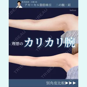 東京シンデレラ美容外科 新宿院 吉原 伯医師の症例