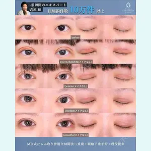 東京シンデレラ美容外科 新宿院 吉原 伯医師の症例