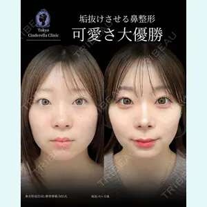 東京シンデレラ美容外科 新宿院 吉原 伯医師の症例
