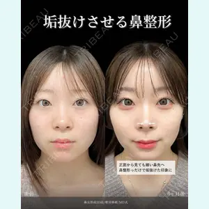 東京シンデレラ美容外科 新宿院 吉原 伯医師の症例