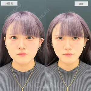 A CLINIC（エークリニック） 仙台院 伊藤 瑠桂医師の症例