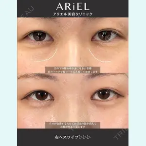 アリエル美容クリニック 大宮院 鈴木　桂介医師の症例