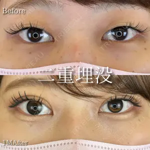 ルラ美容クリニック 岡山院の症例