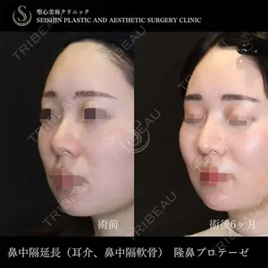 聖心美容クリニック 六本木院 川端 優也医師の症例