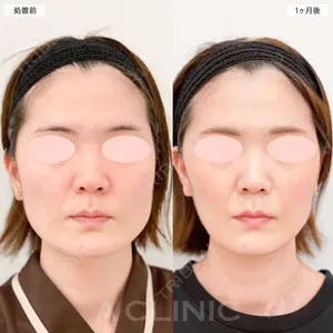 症例