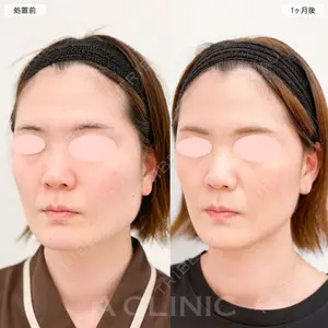 症例