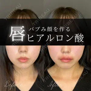 ルラ美容クリニック 大宮院 右京 大季医師の症例