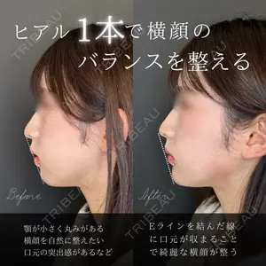 ルラ美容クリニック 大宮院 右京 大季医師の症例