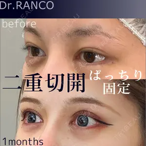 症例